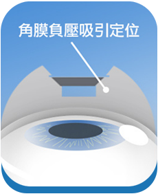 澄欣眼科診所 澄欣眼科診所