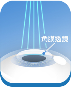澄欣眼科診所 澄欣眼科診所