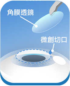澄欣眼科診所 澄欣眼科診所